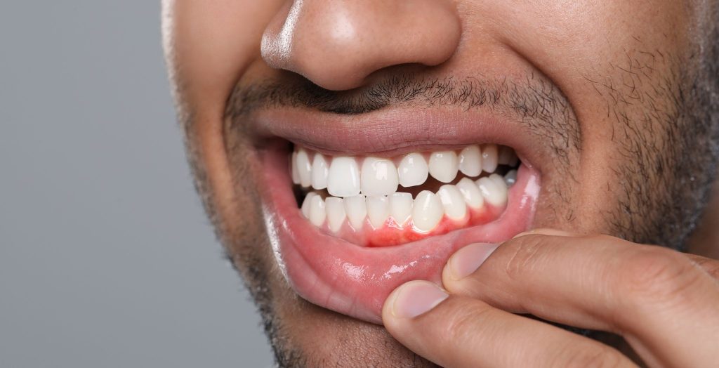 7 Warning Signs You Should Visit a Periodontist Immediately