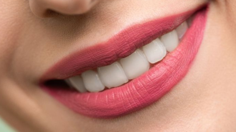 Untitled design 2026 03 24T105311.618