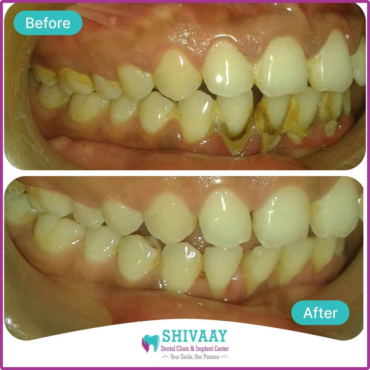 3772875e b798 400f 8765 2b5c57561c9a 1