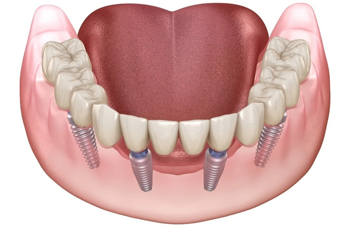 56a11a02 d39b 4a74 a679 89f7ea356583