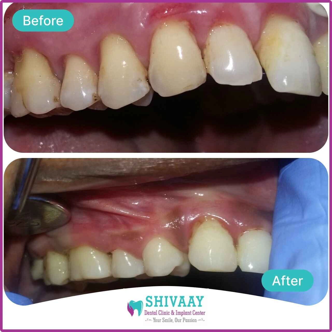 6e373b56 59af 463b b0c6 26467e03c538 1