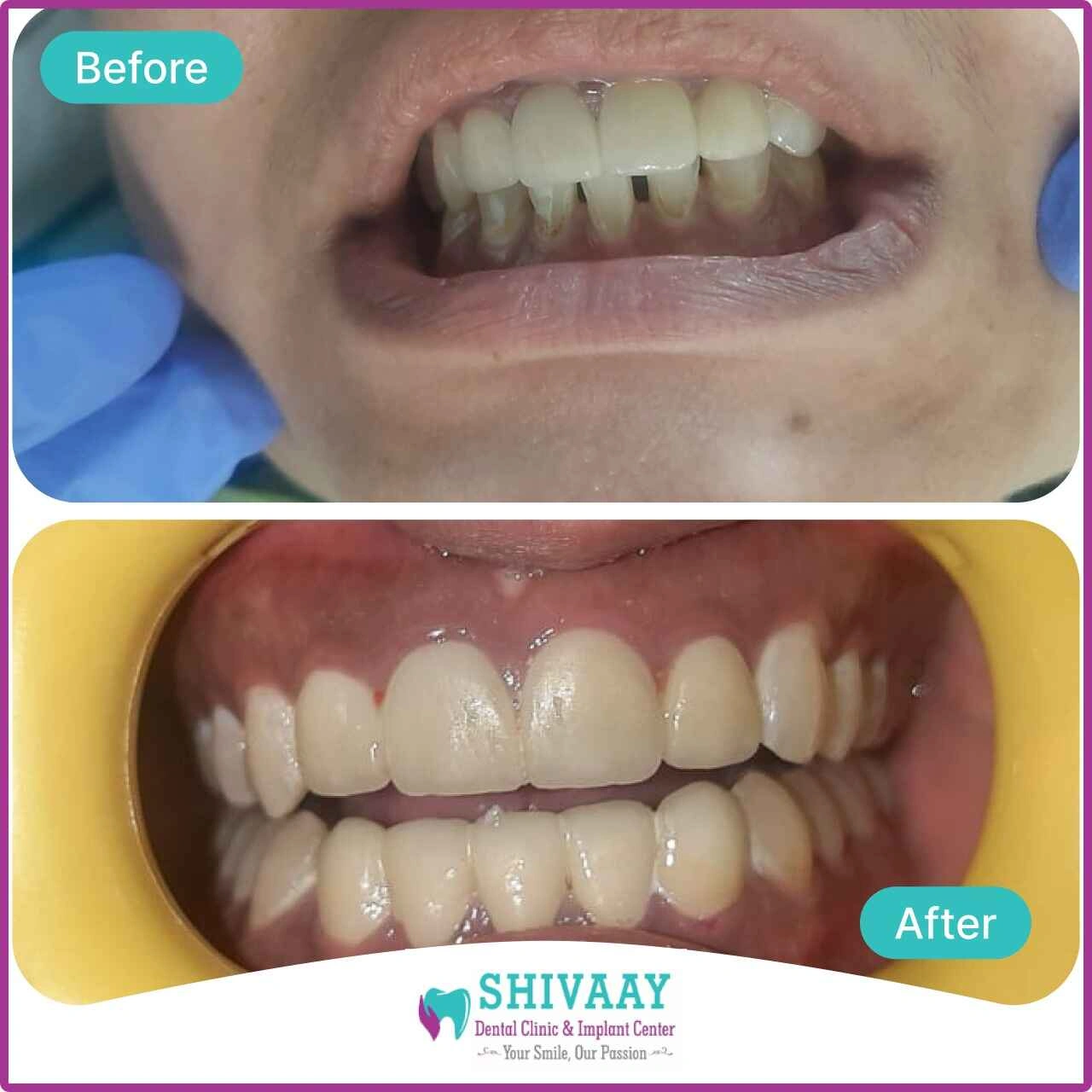 90cac30a 72e4 43af 8581 aa32f186fdfb 1