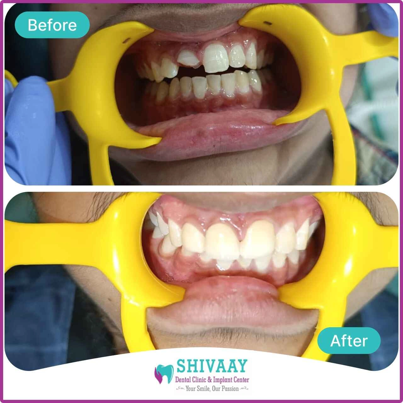 91aff3ab-8a2b-43d2-9c53-cfa080a4ab4d-1-1