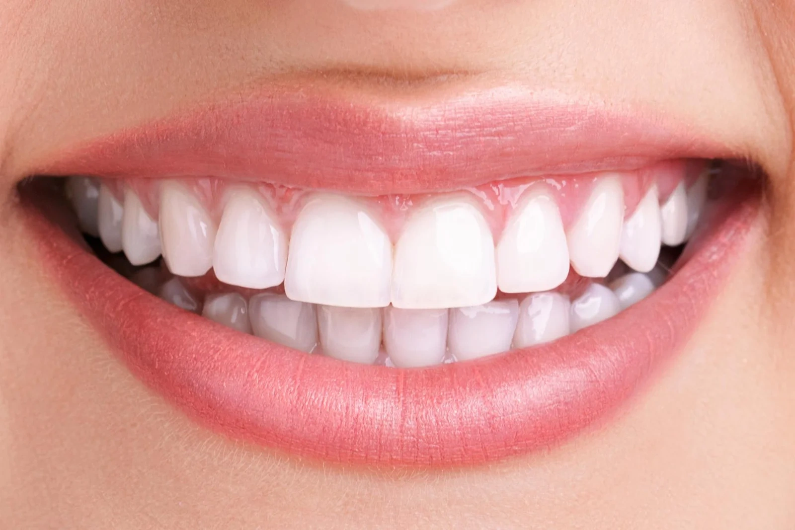 Teeth whitening 1 1