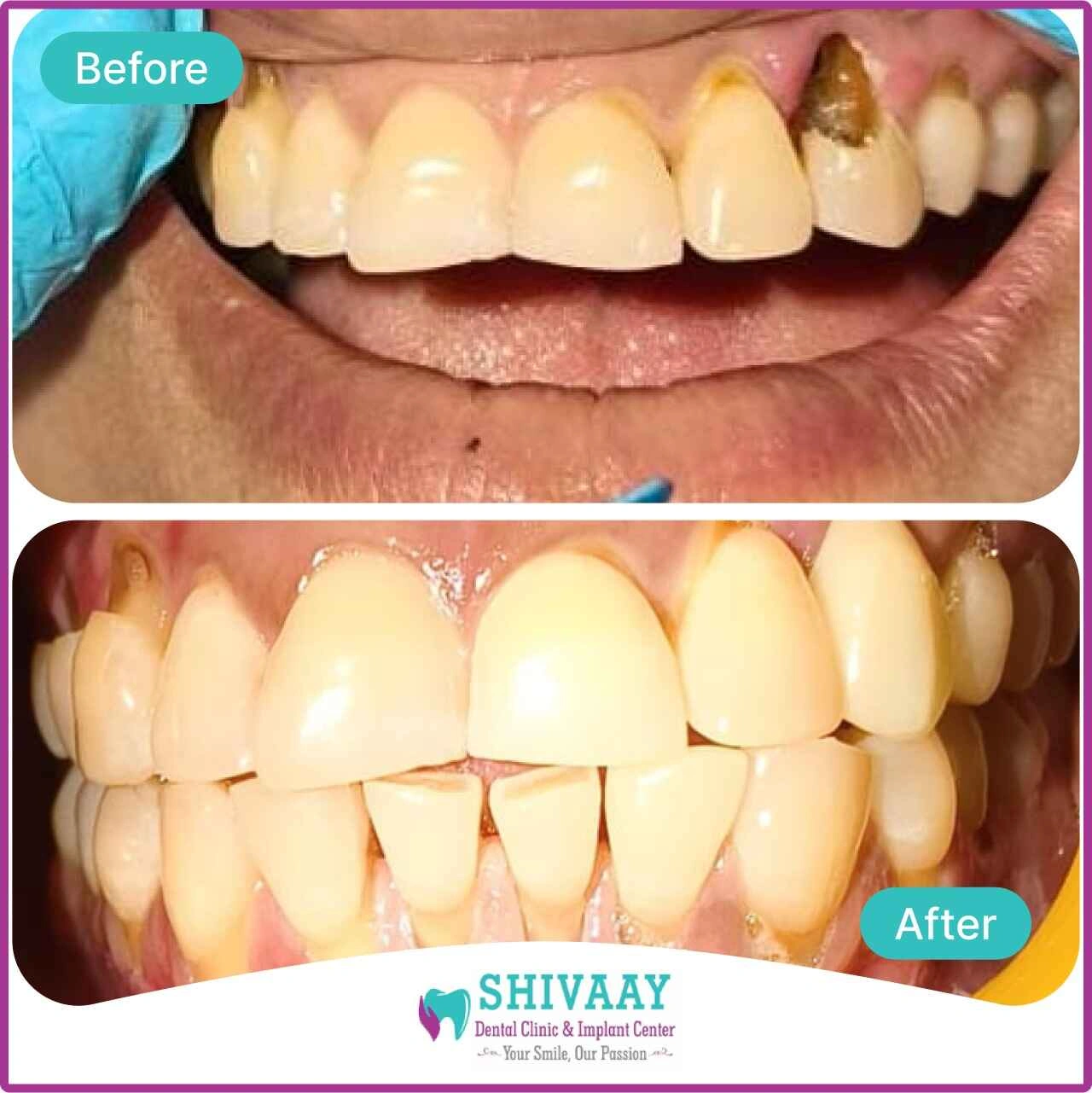 bf1664d4-1464-43db-a0c0-c8086cf3d406-1