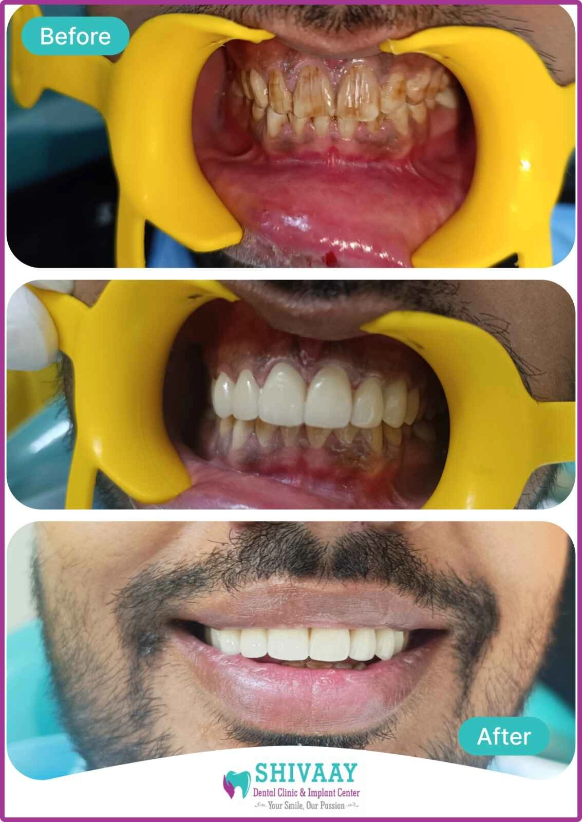 cff516cf f18f 4170 aa68 8f57447d712d 1