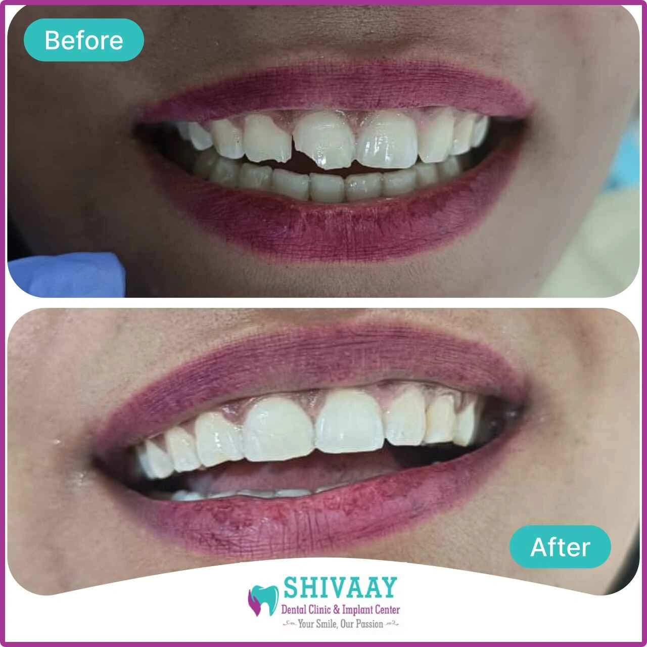 d62c40d2 d93d 49e2 86a2 b856061e2019 1