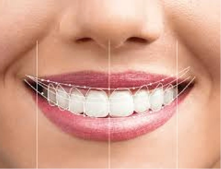 dd3d9588 f4f8 42e4 b28b 3dabd2294e62