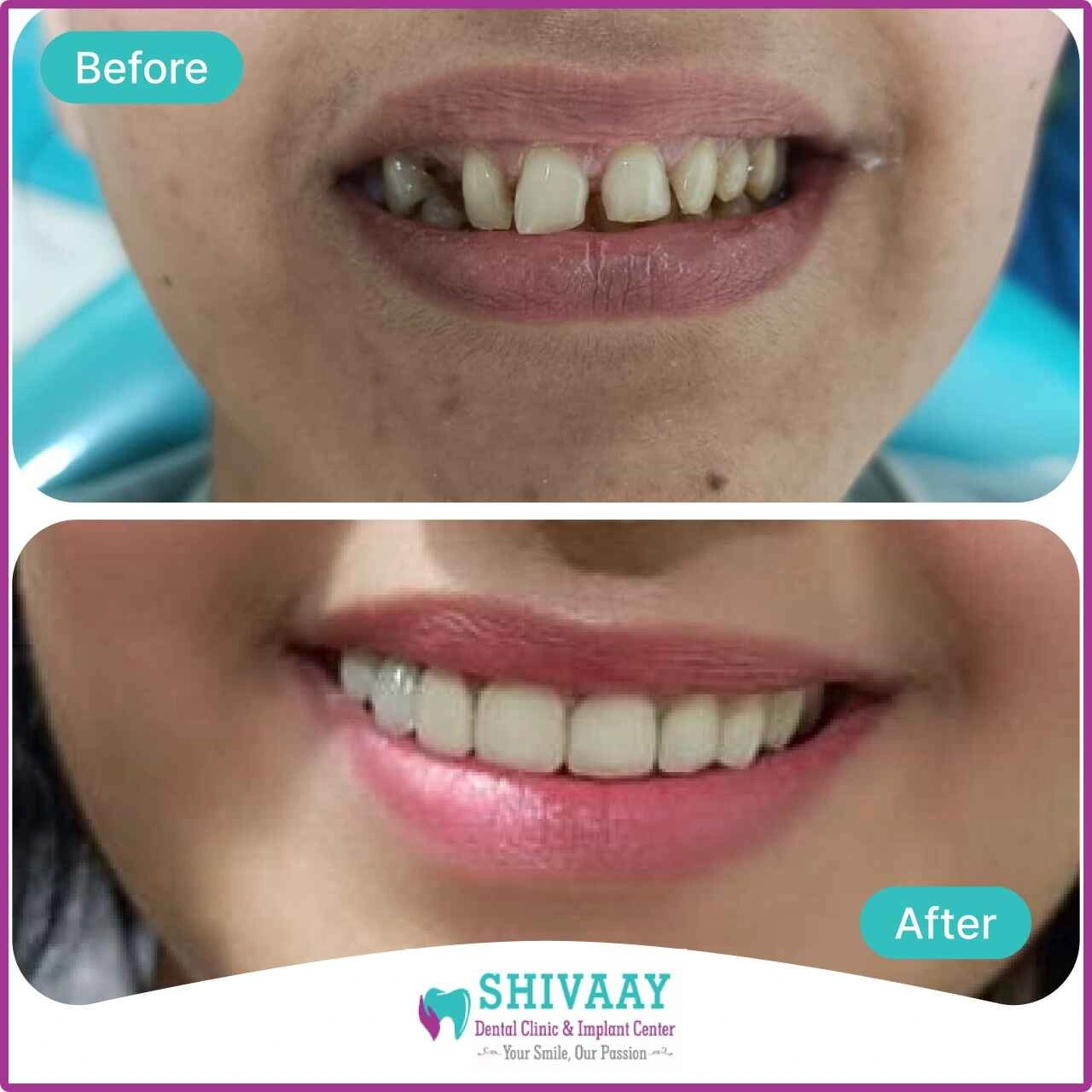 ecaf4912-c9b7-486f-92ce-952d21774e72-1