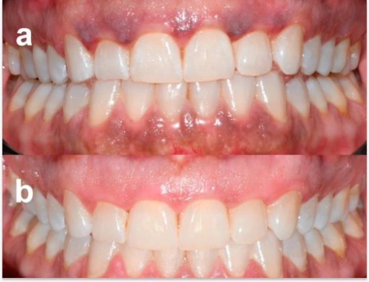 f59b7f4b b5da 4f92 b4d8 6bb3386c7dbd